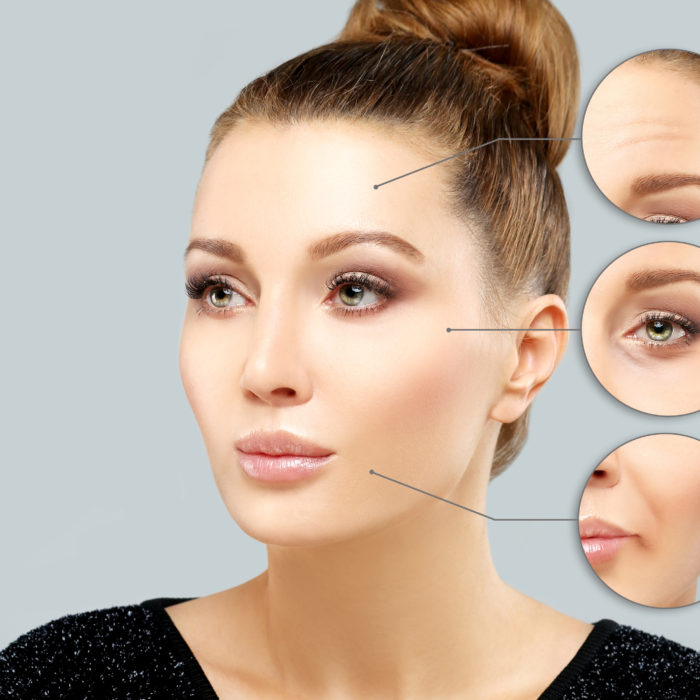 Anti-Wrinkle Injections (Botox) treatment in Limerick